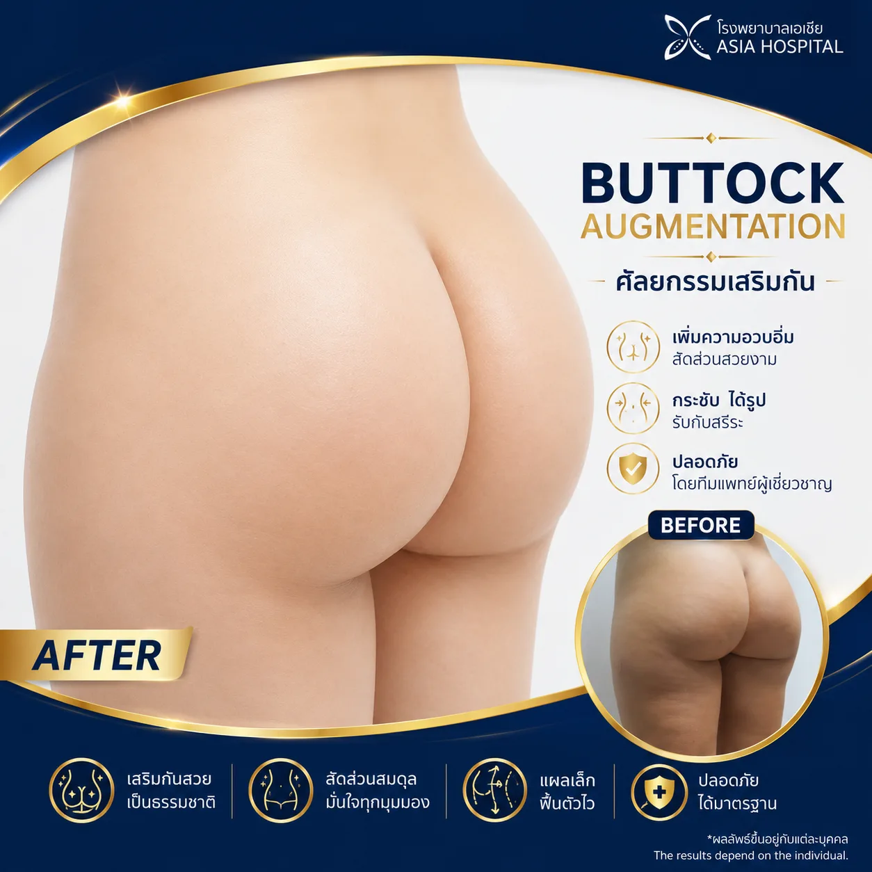 ก่อน-หลัง ศัลยกรรมรูปร่าง