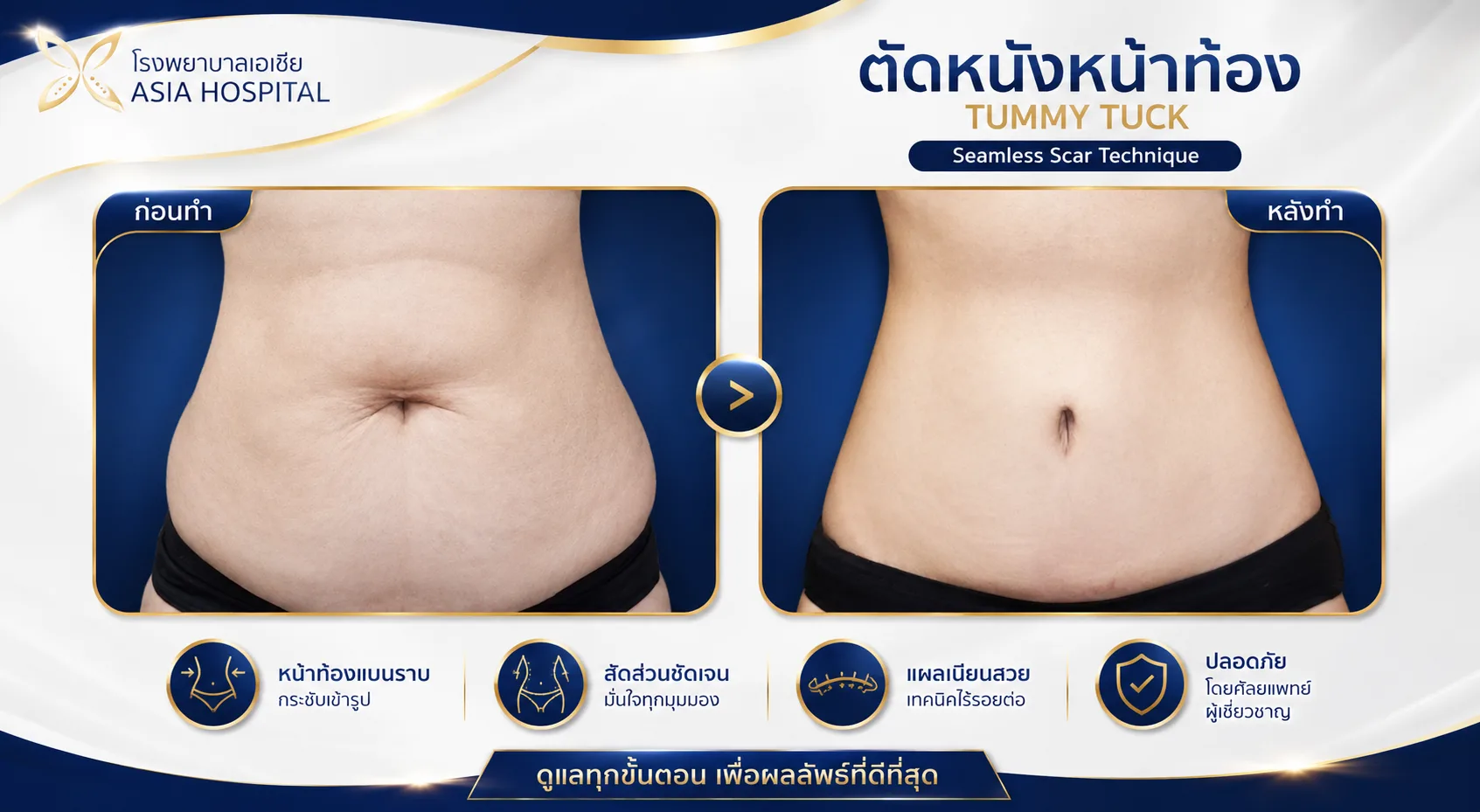 ก่อน-หลัง ศัลยกรรมรูปร่าง