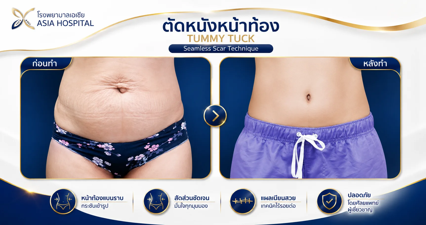 ก่อน-หลัง ศัลยกรรมรูปร่าง