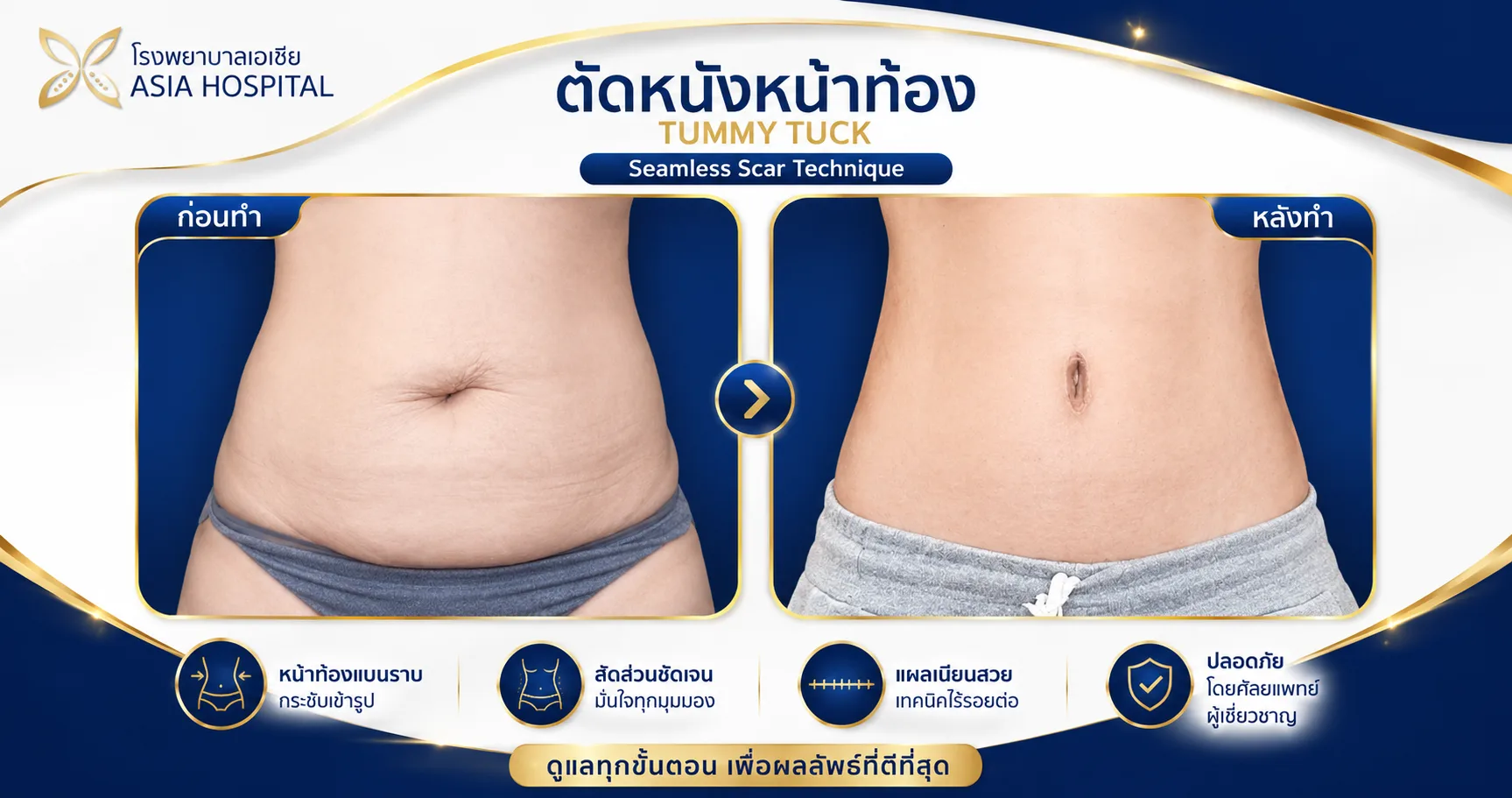 ก่อน-หลัง ศัลยกรรมรูปร่าง