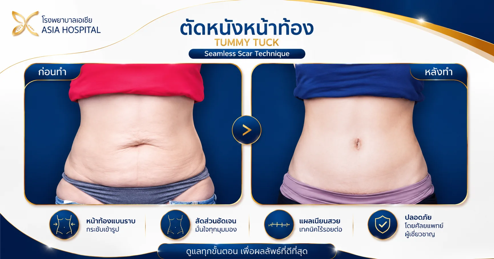ก่อน-หลัง ศัลยกรรมรูปร่าง