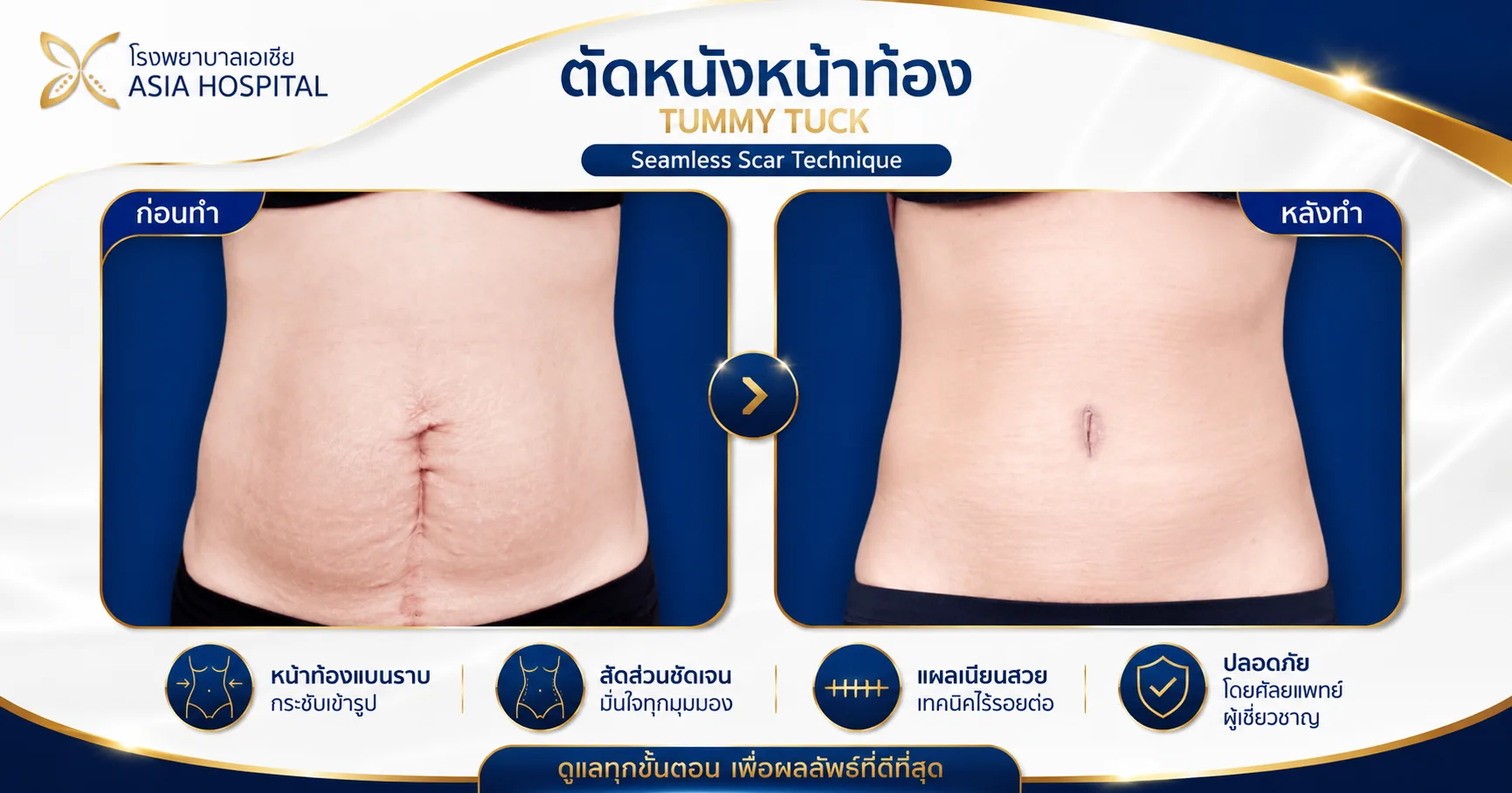 ก่อน-หลัง ศัลยกรรมรูปร่าง