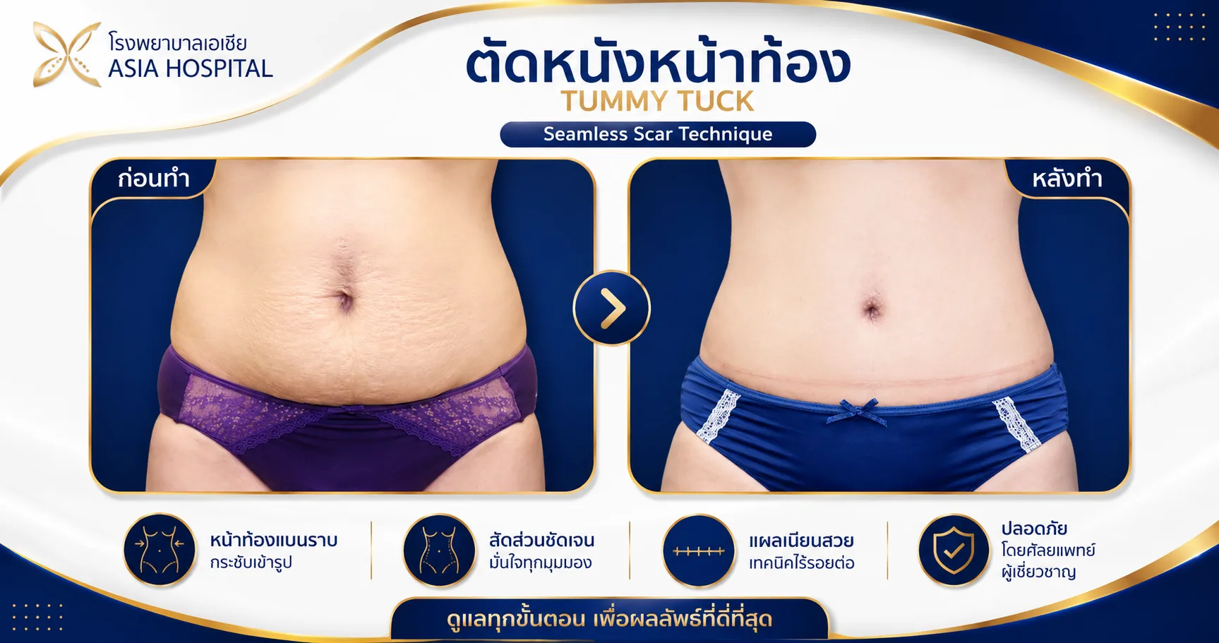 ก่อน-หลัง ศัลยกรรมรูปร่าง