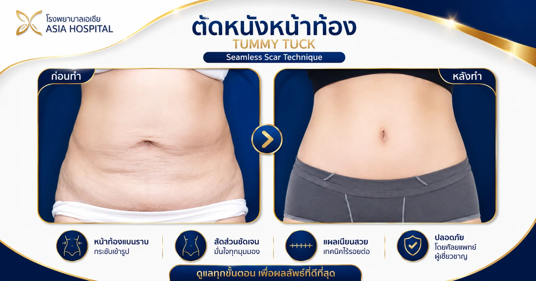 ก่อน-หลัง ศัลยกรรมรูปร่าง