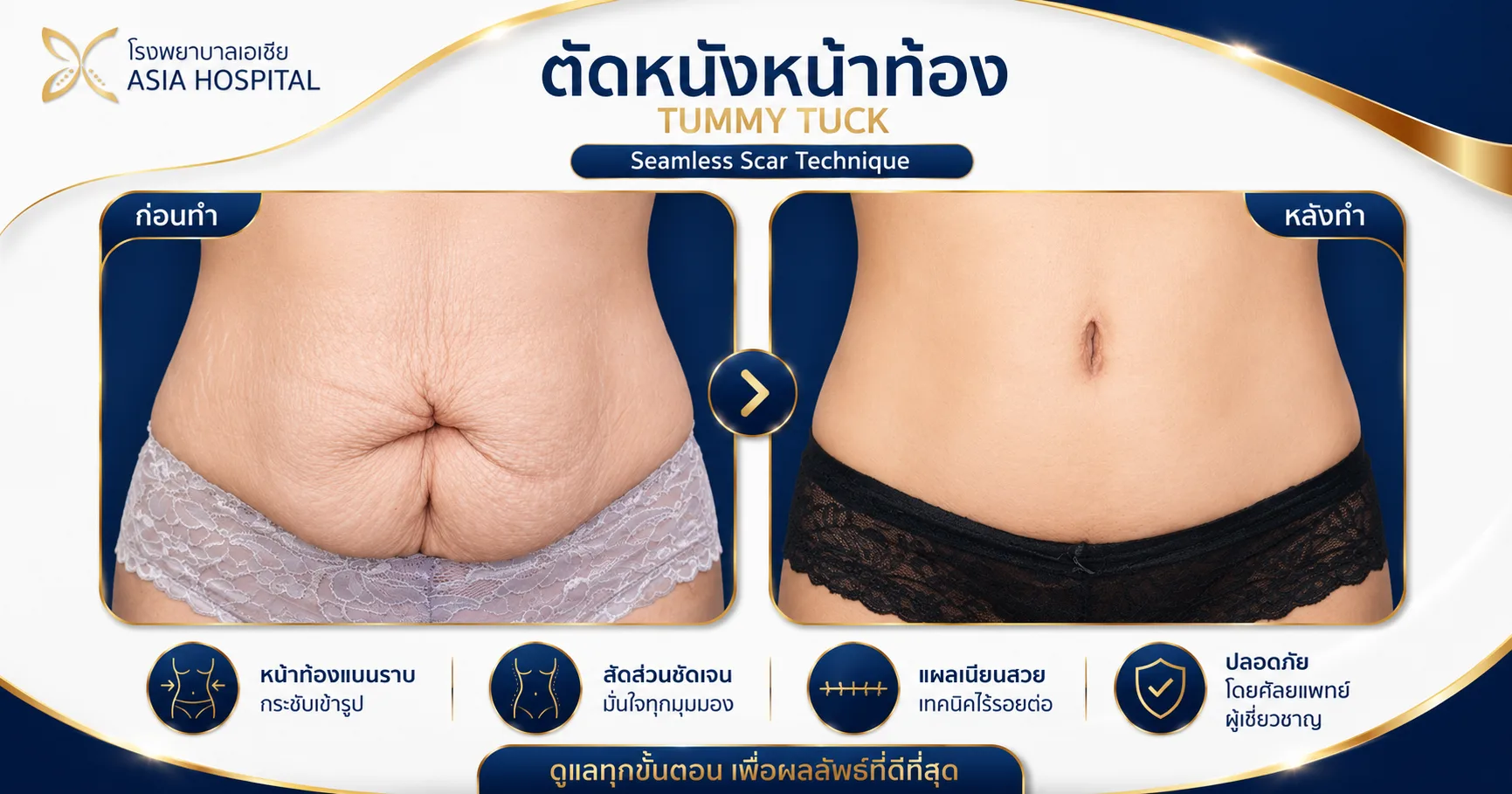 ก่อน-หลัง ศัลยกรรมรูปร่าง