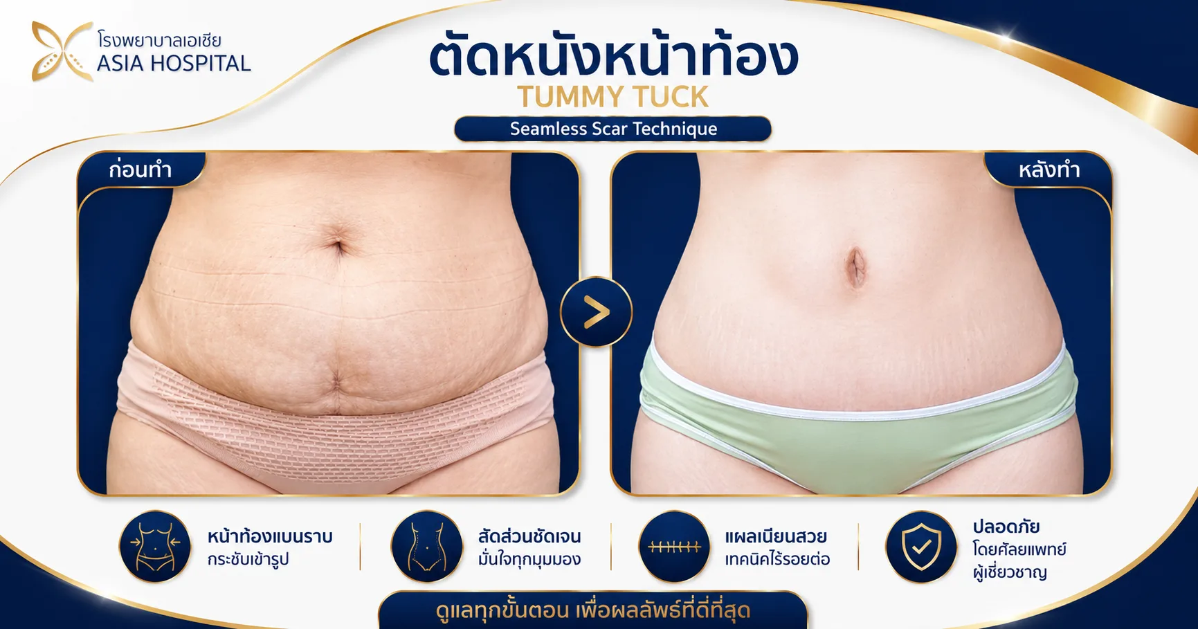 ก่อน-หลัง ศัลยกรรมรูปร่าง