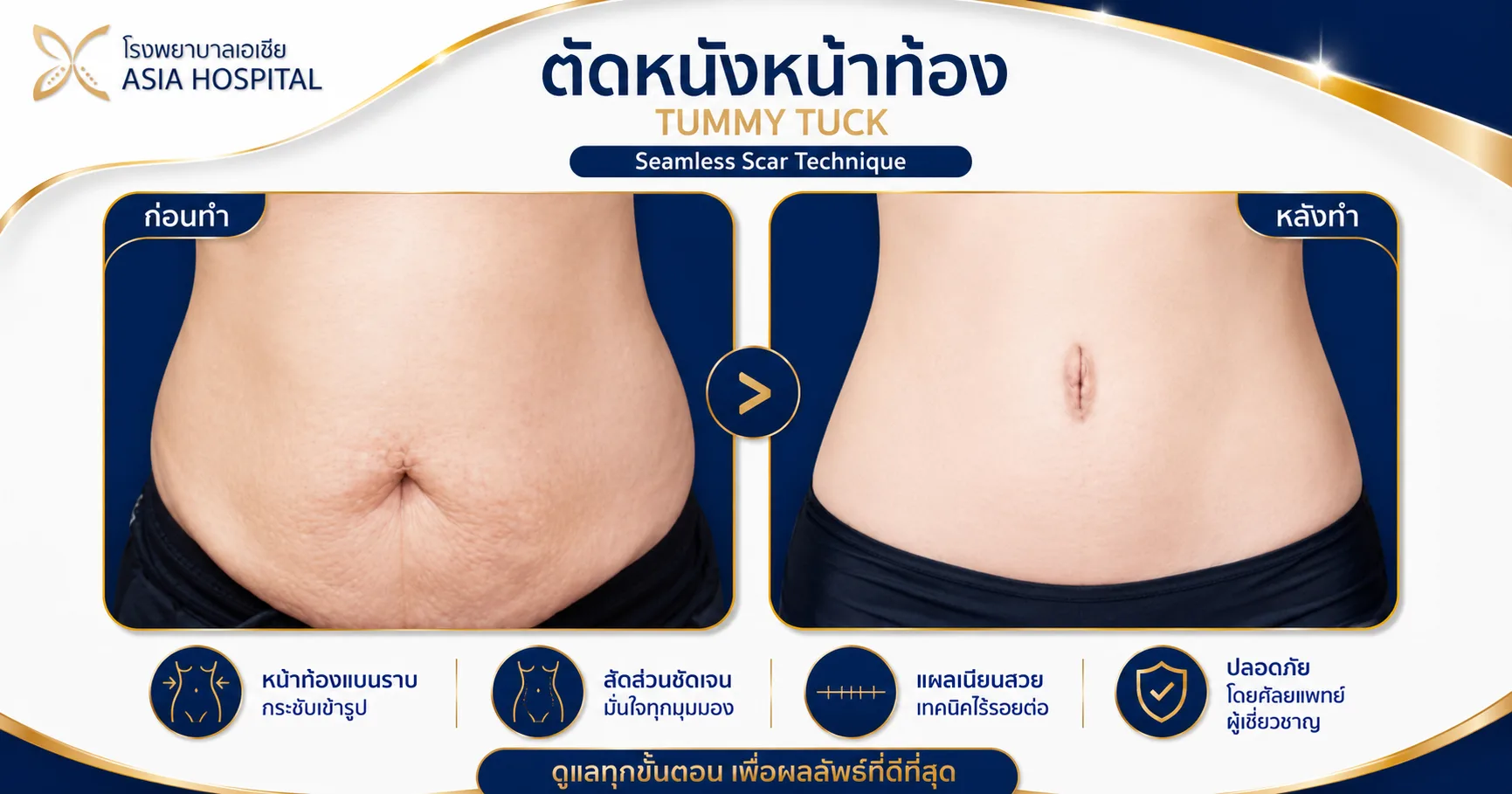 ก่อน-หลัง ศัลยกรรมรูปร่าง