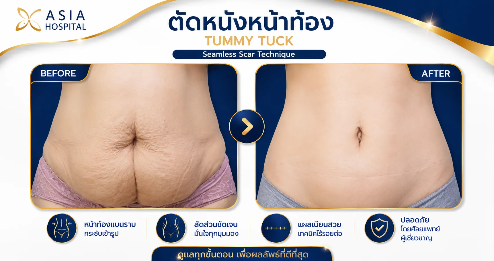 ก่อน-หลัง ศัลยกรรมรูปร่าง