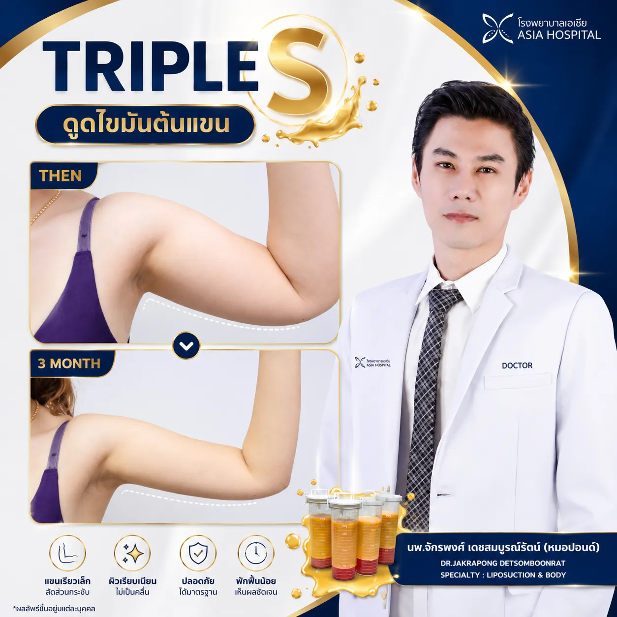 ก่อน-หลัง ดูดไขมันต้นแขน