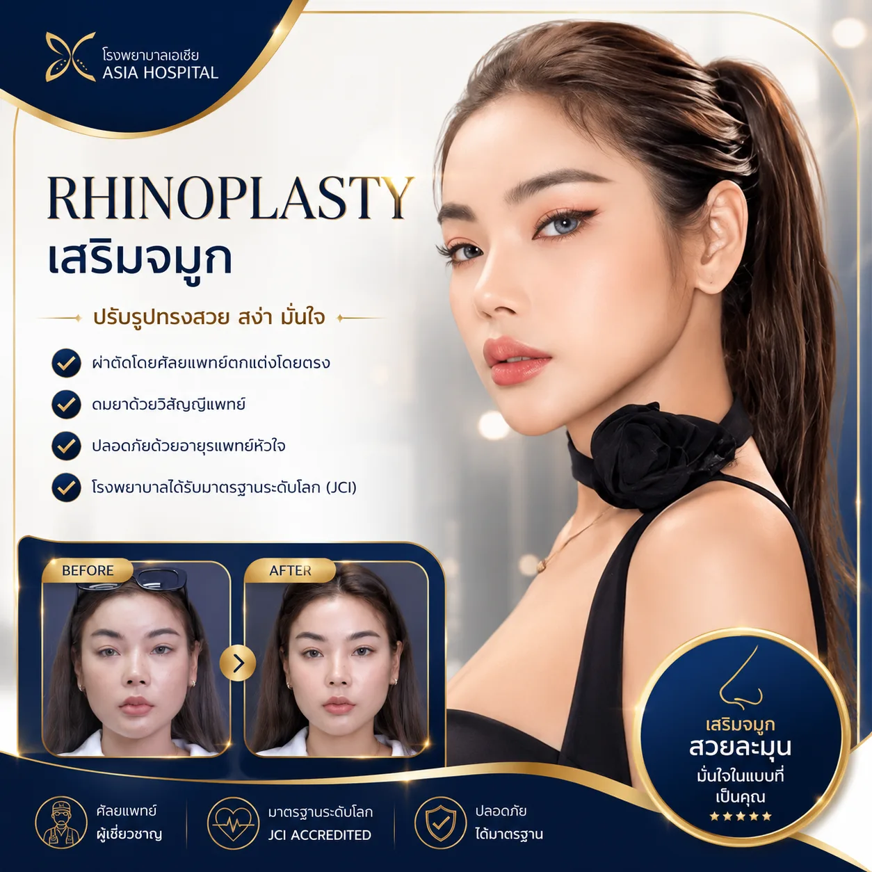 ก่อน-หลัง ศัลยกรรมจมูก