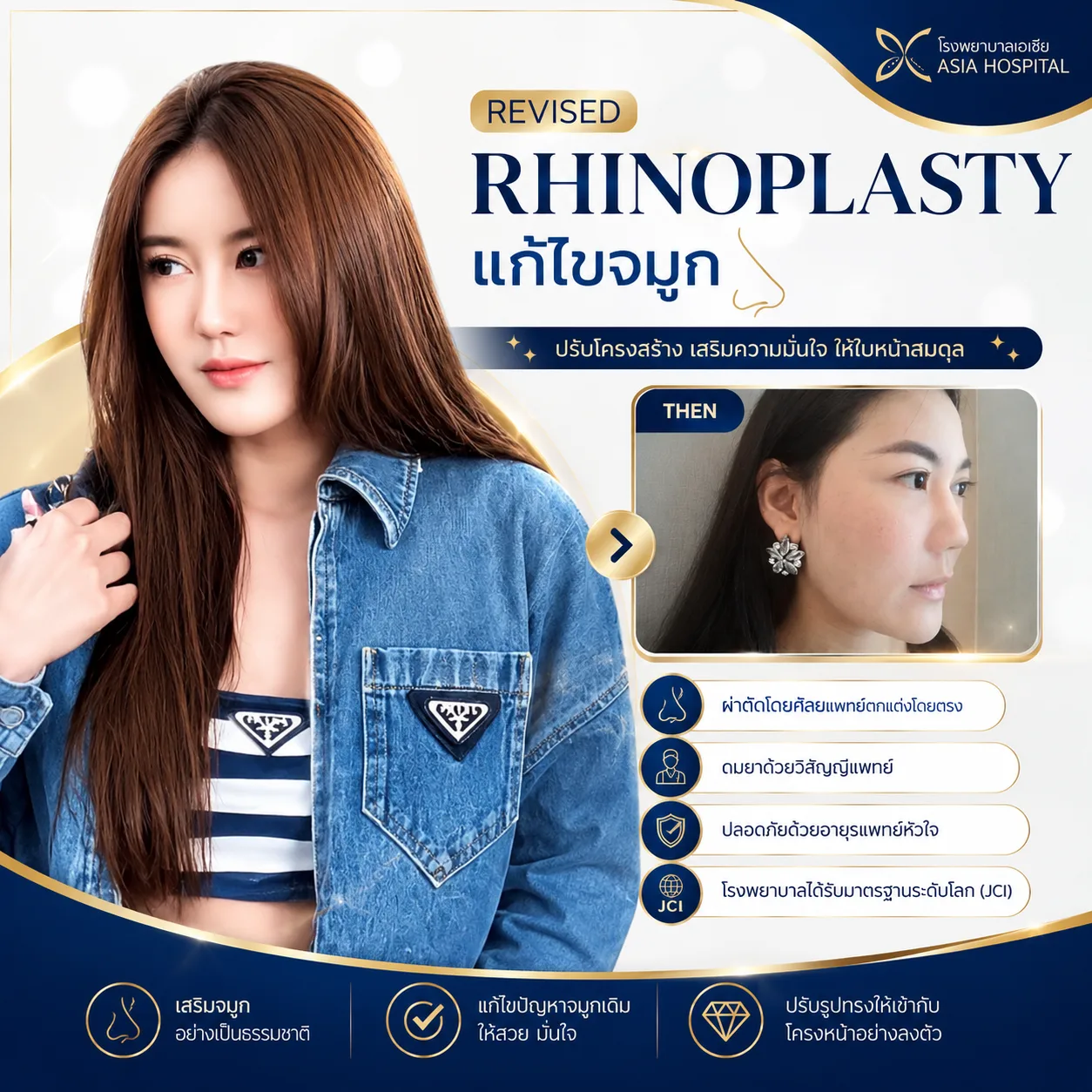 ก่อน-หลัง ศัลยกรรมจมูก