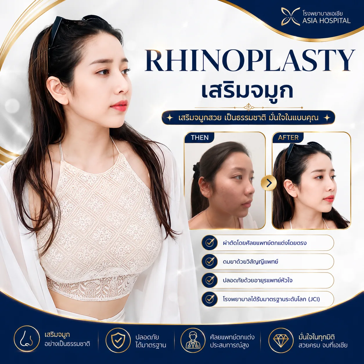 ก่อน-หลัง ศัลยกรรมจมูก