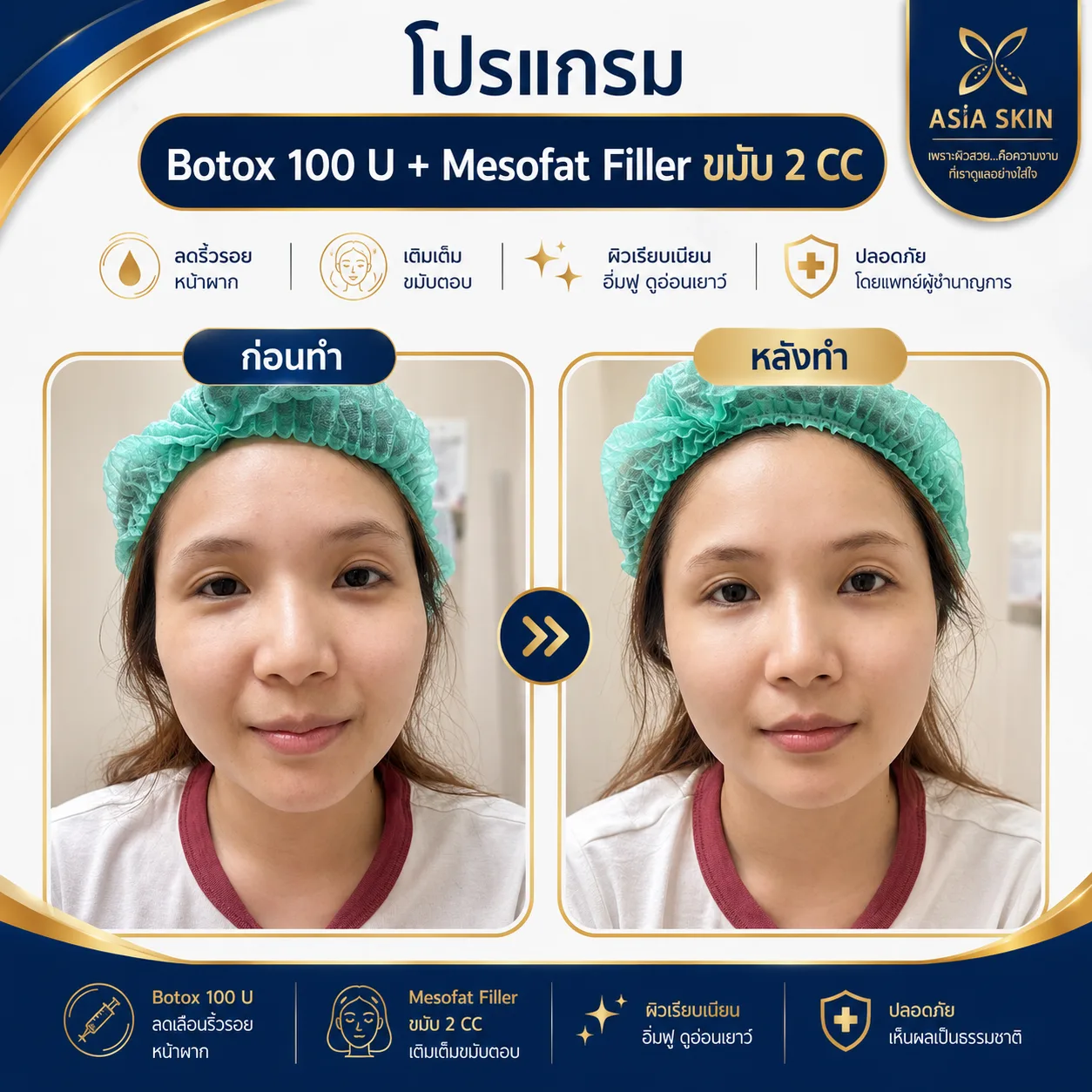 ดูแลผิวพรรณ ก่อน-หลัง