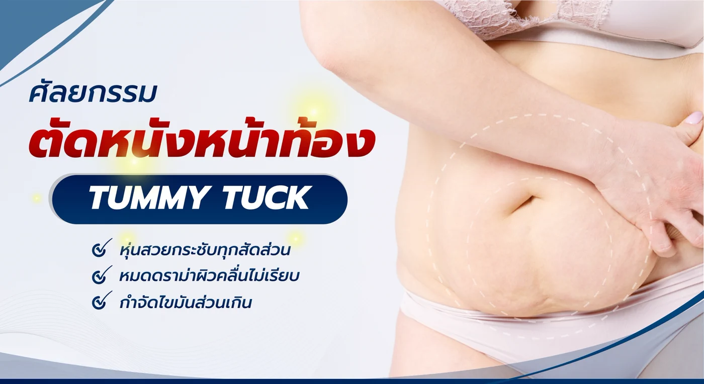 ข้อมูลศัลยกรรมตัดหนังหน้าท้อง Tummy Tuck ช่วยให้หุ่นกระชับ ลดผิวคลื่นไม่เรียบ และกำจัดไขมันส่วนเกิน
