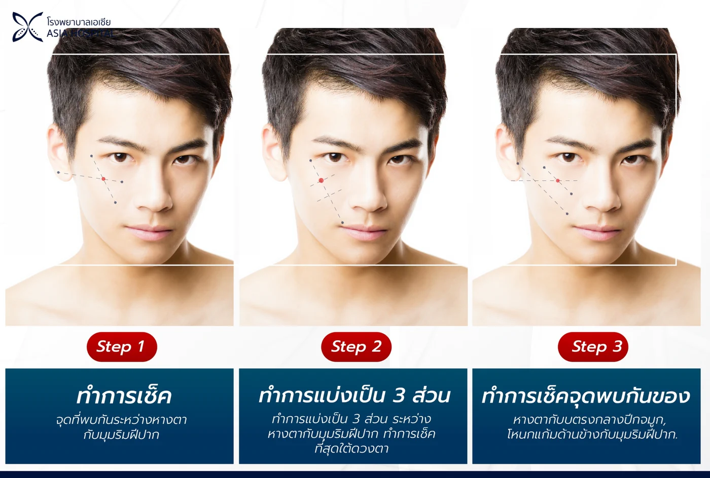 ขั้นตอนการผ่าตัดยุบโหนกแก้ม