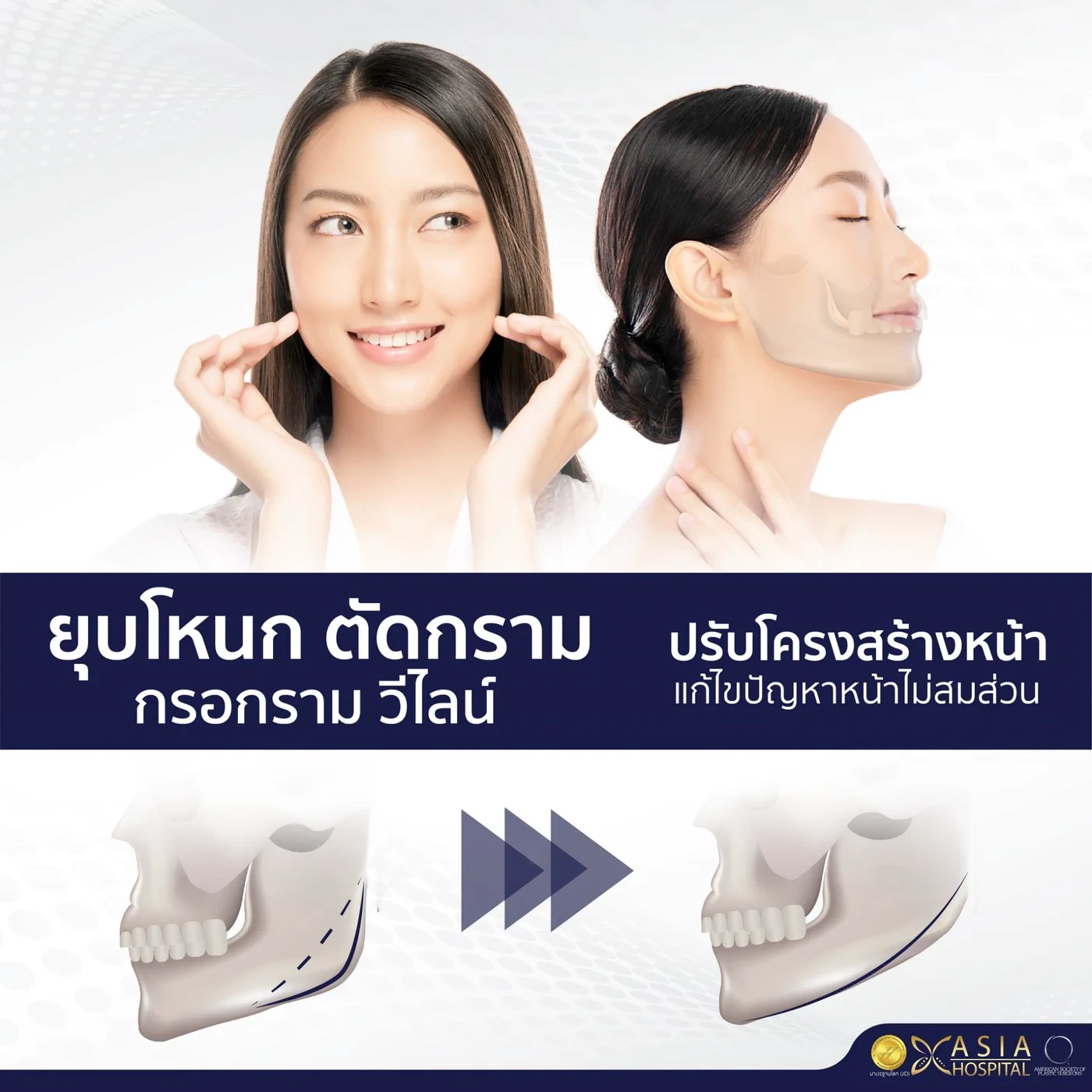 ข้อมูลศัลยกรรมตัดกราม กรอกราม V-Line