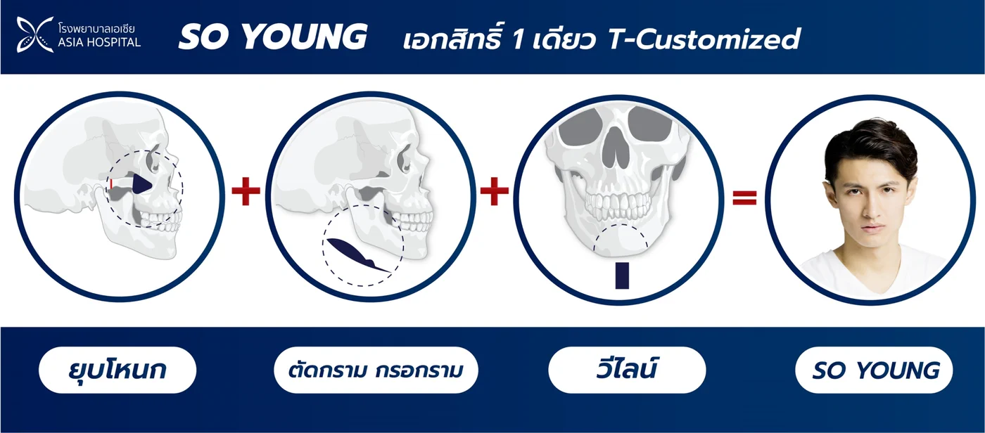 แผนภาพการกรอลดความหนาของกระดูกกราม