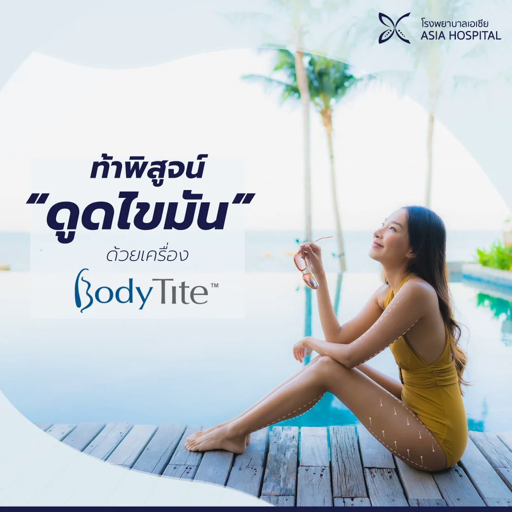 ข้อมูลการดูดไขมันด้วยเครื่อง BodyTite พร้อมเส้นกำหนดบริเวณต้นขาและสะโพกที่รับการรักษา