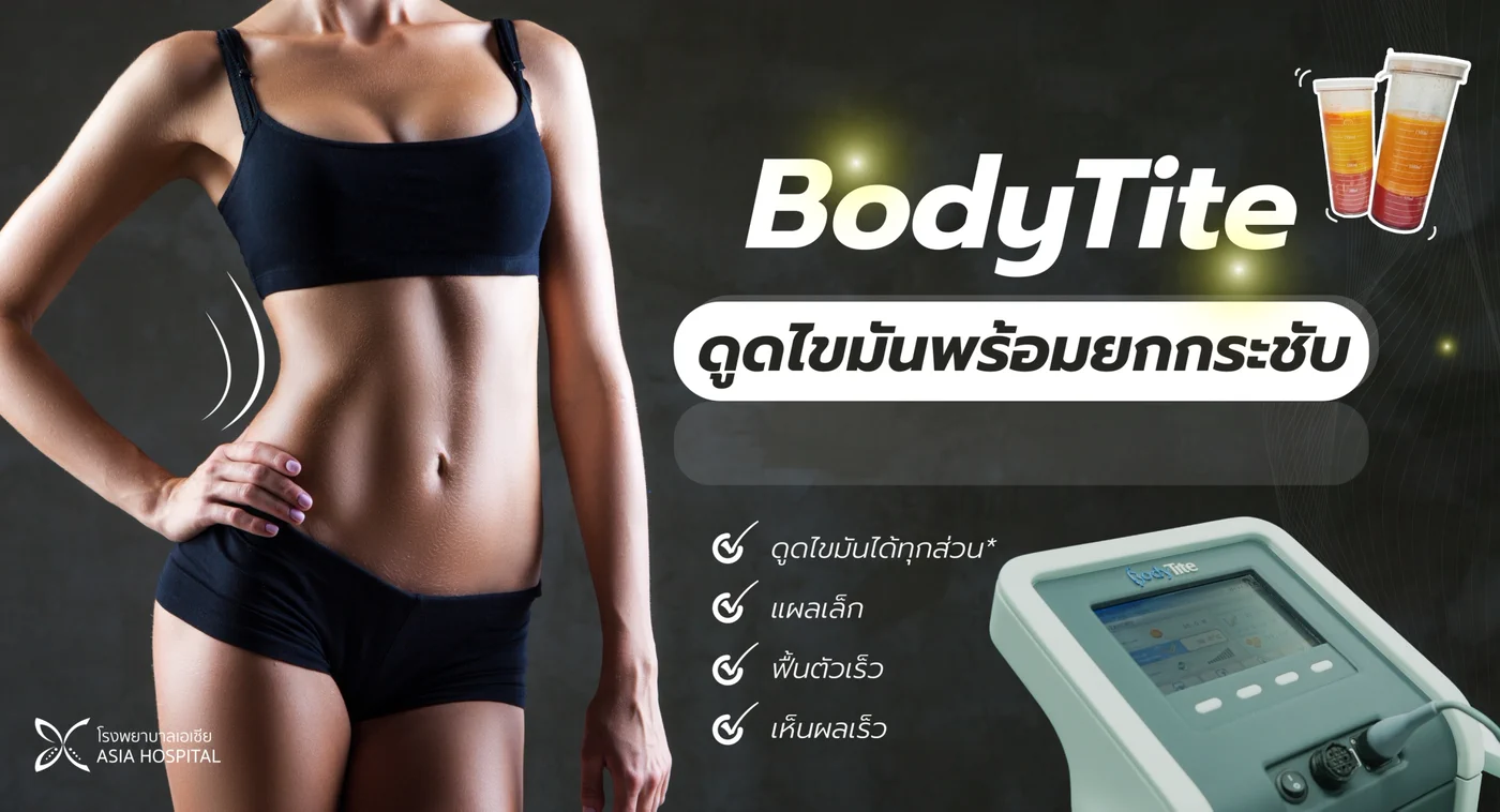 ข้อมูลการดูดไขมันพร้อมยกกระชับด้วยเครื่อง BodyTite ดูดไขมันได้ทุกส่วน แผลเล็ก ฟื้นตัวเร็ว เห็นผลเร็ว