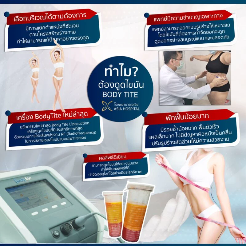 เหตุผลที่เลือกดูดไขมันด้วย BodyTite เลือกบริเวณได้ตามต้องการ แพทย์เฉพาะทางออกแบบรูปร่าง เครื่องรุ่นใหม่ใช้คลื่น RF พักฟื้นน้อย และผลลัพธ์เรียบเนียน