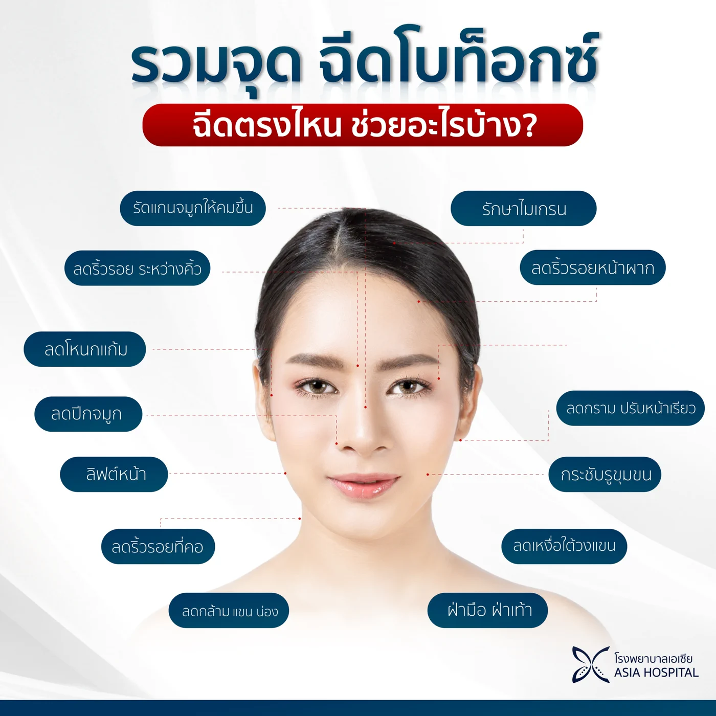 แผนภาพรวมจุดฉีดโบท็อกซ์บนใบหน้าและร่างกาย เช่น ลดริ้วรอยหน้าผากและระหว่างคิ้ว ลดกราม ลดโหนกแก้ม ลิฟต์หน้า กระชับรูขุมขน ลดกล้ามแขนและน่อง และลดเหงื่อใต้วงแขน