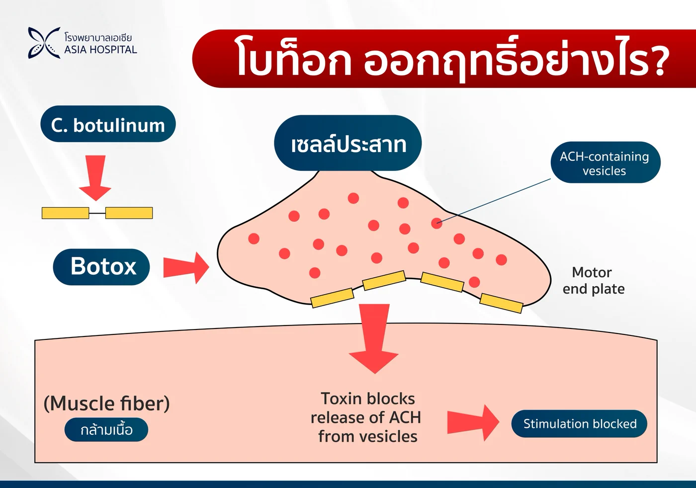 แผนภาพกลไกการออกฤทธิ์ของโบท็อกซ์ สารจาก C. botulinum เข้าไปยับยั้งการหลั่งสาร ACH จากปลายเซลล์ประสาทที่ motor end plate ทำให้กล้ามเนื้อไม่ถูกกระตุ้น